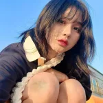 뇌진탕+얼굴 상처까지…50만 유튜버 노은솔, 교통사고 근황 공개