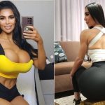 “킴 카다시안처럼…” 불법 수술 후 심장마비로 사망한 모델