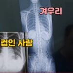 정형외과 브이로그 찍으며 자연 H컵 가슴 인증한 여캠BJ