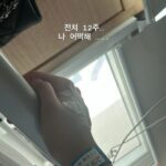 배우 고아성 전치 12주 부상 전하다