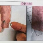 학교 급식용 햄에서 나온 ‘이것’. 알고 보니 돼지 지혈제