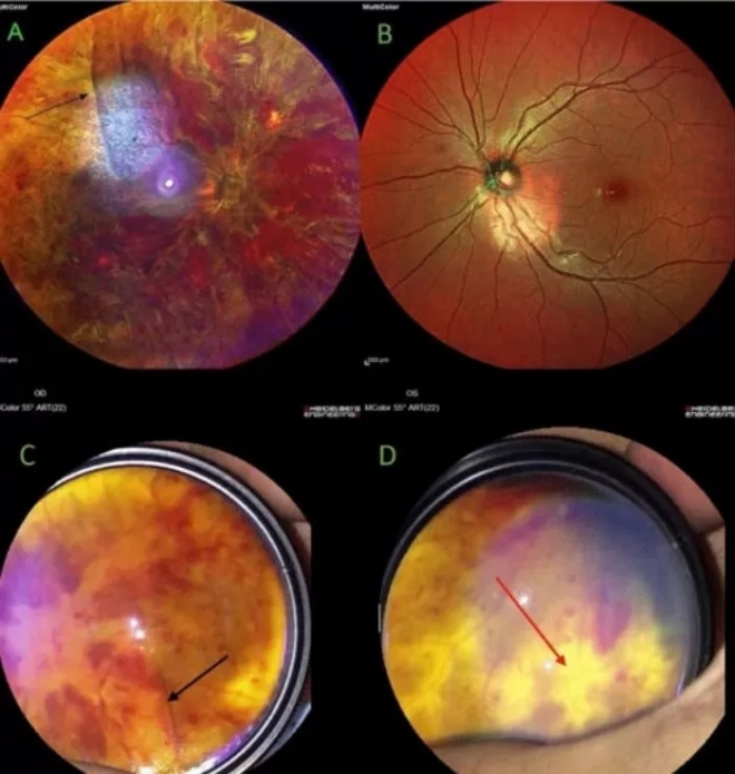 Journal of Medical Case Reports