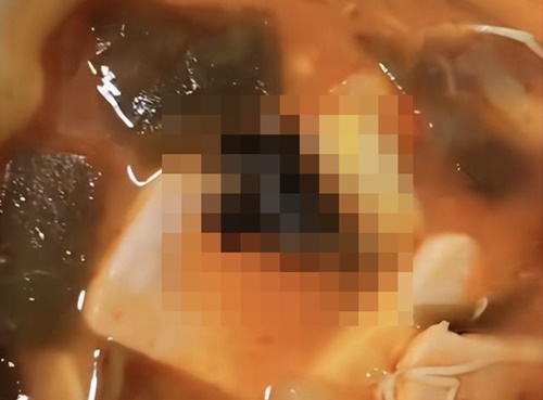 마라탕에서 나온 충격적인 이물질, 식품위생 논란 또 일어난 중국(영상)