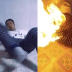 누운 채 방귀 끼다가… 엉덩이에 불붙은 남성(영상)