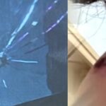 새총 쏴서 고교생 코뼈 부러트린 30대 남성. 새총 쏜 이유가….