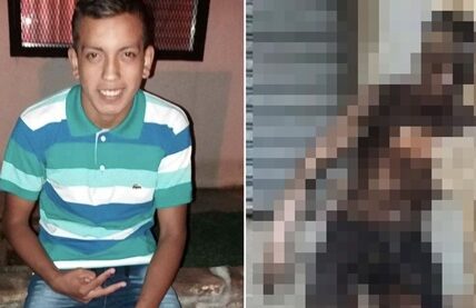 고압선 훔치려다 신체 90%에 화상… 사망한 20대 아르헨 청년