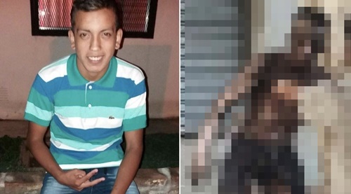 고압선 훔치려다 신체 90%에 화상… 사망한 20대 아르헨 청년